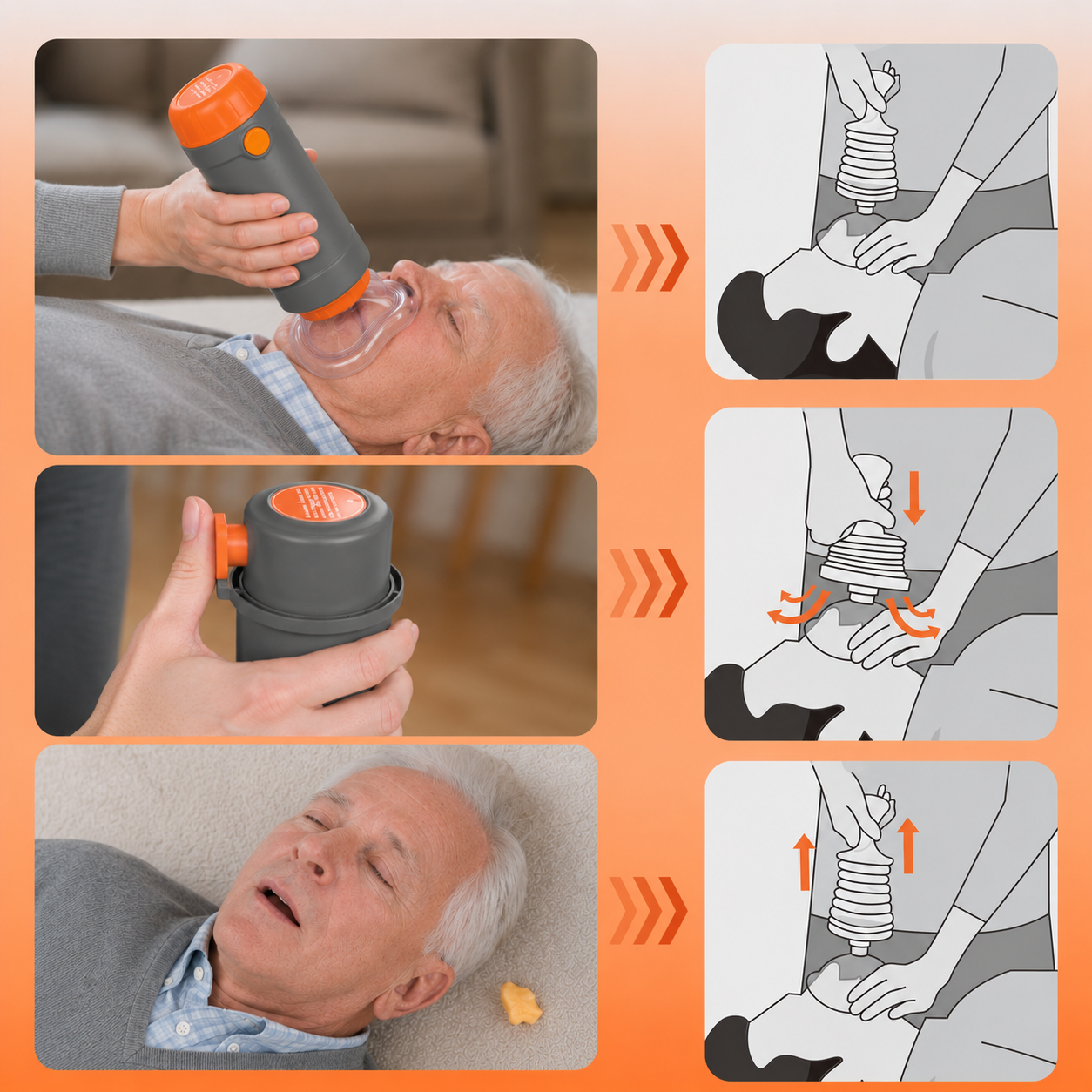 Choking Rescue Device